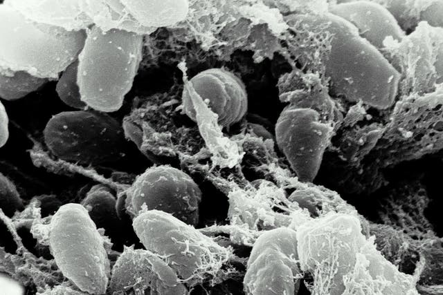 A 15-year-old Kyrgyzstani herder has died of bubonic plague after being bitten by a flea – the first case of Black Death in the country for over 30 years.