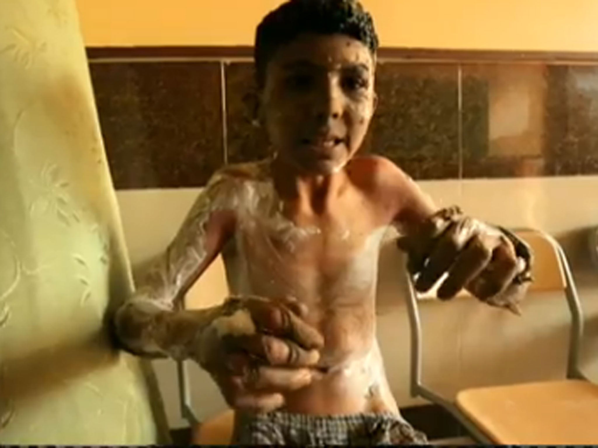 WARNING: GRAPHIC IMAGES BBC Panorama has released footage of an apparent incendiary bombing of a playground in Aleppo, northern Syria, with 15-year-old Ahmed (pictured) among those injured