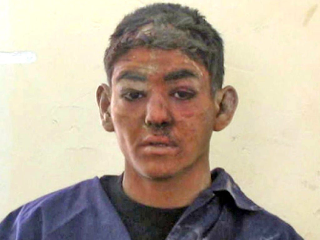 Detainee 722 who was allegedly assaulted