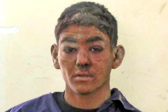 Detainee 722 who was allegedly assaulted