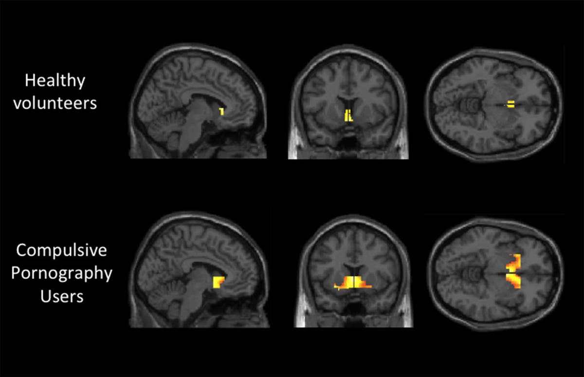 porn-addiction-brain-scan.jpg?width=1200