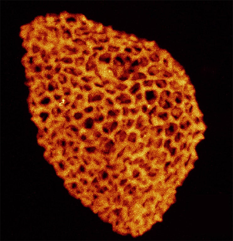 A microscopic photograph of a fossilised pollen grain