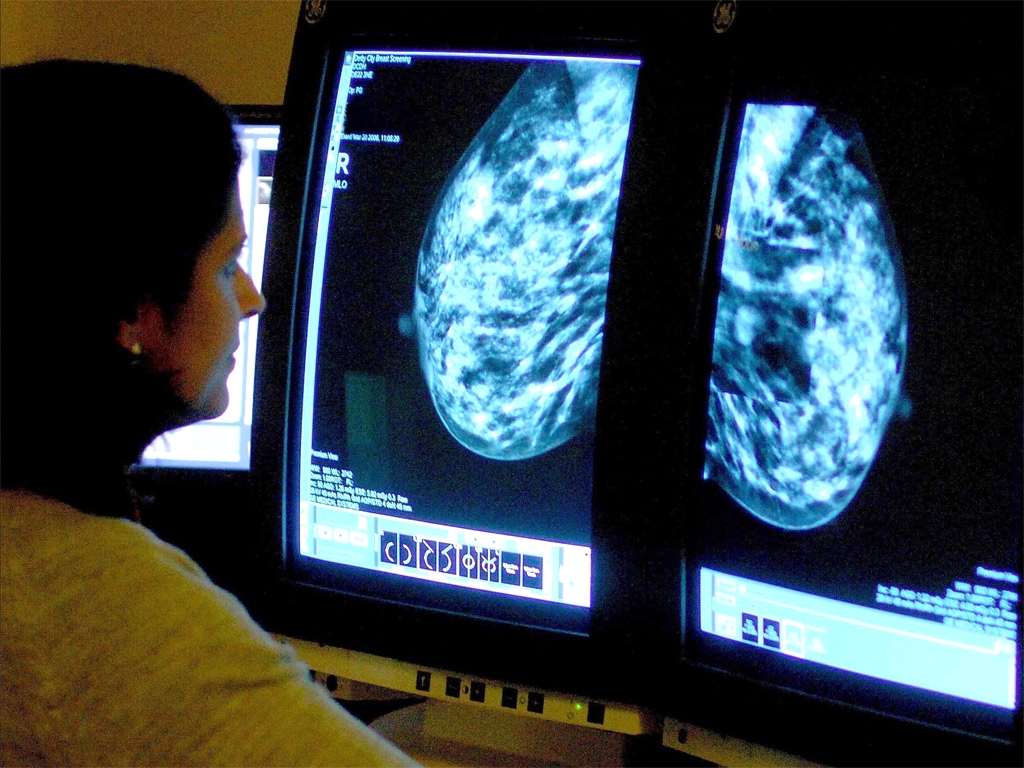 Consultant analyses mammogram of cancer patient