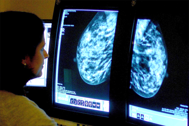 Consultant analyses mammogram of cancer patient