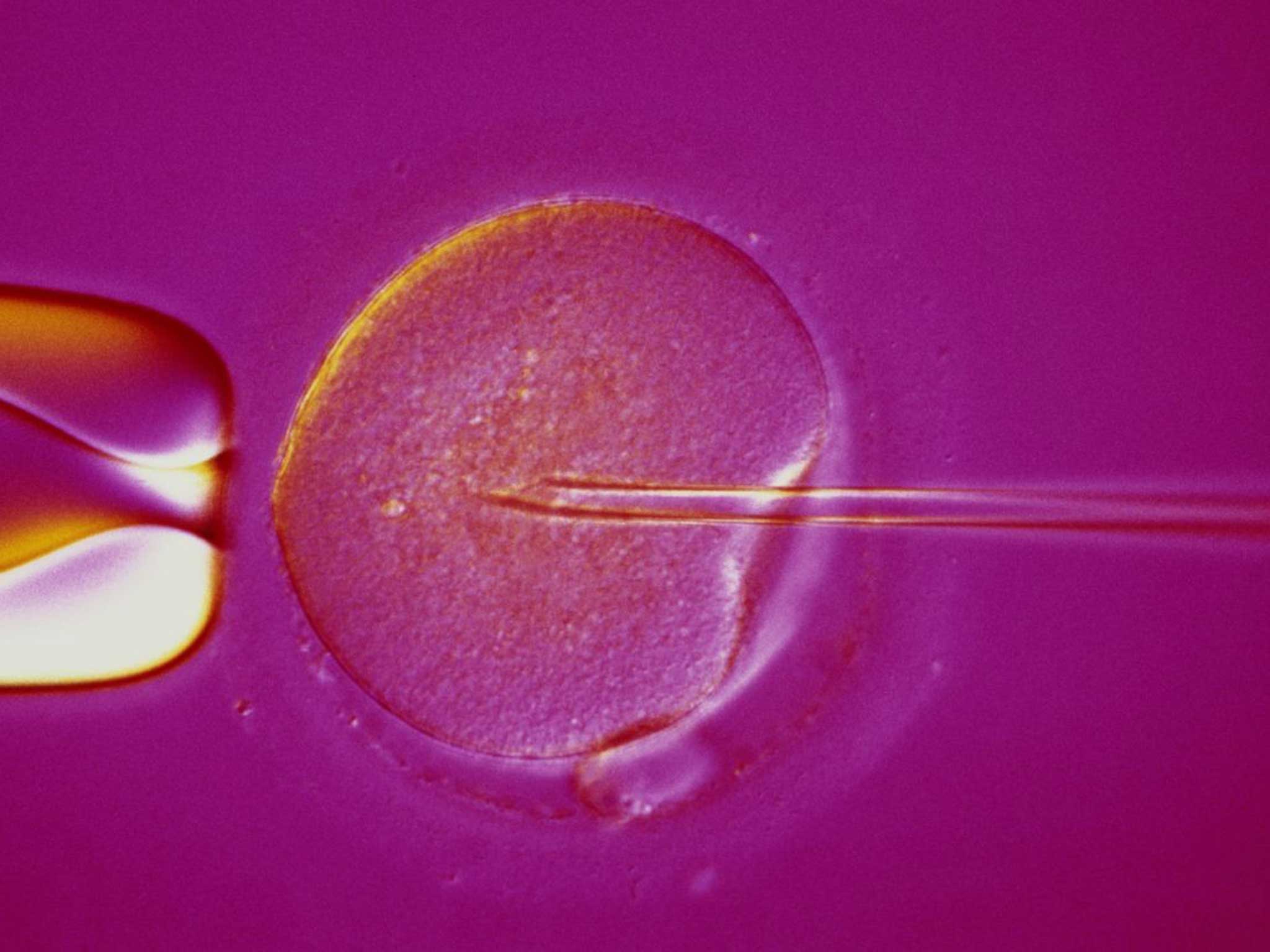 Intracytoplasmic sperm injection is used in about half the cases