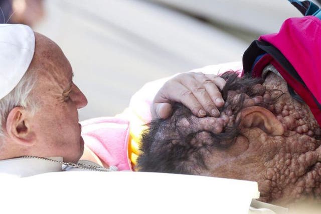 Pope Francis caresses a sick person in Saint Peter's Square at the end of his General Audience in Vatican City