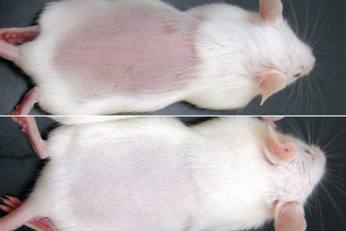 Fountain of youth? Scientists discover why wounds heal quicker for ...
