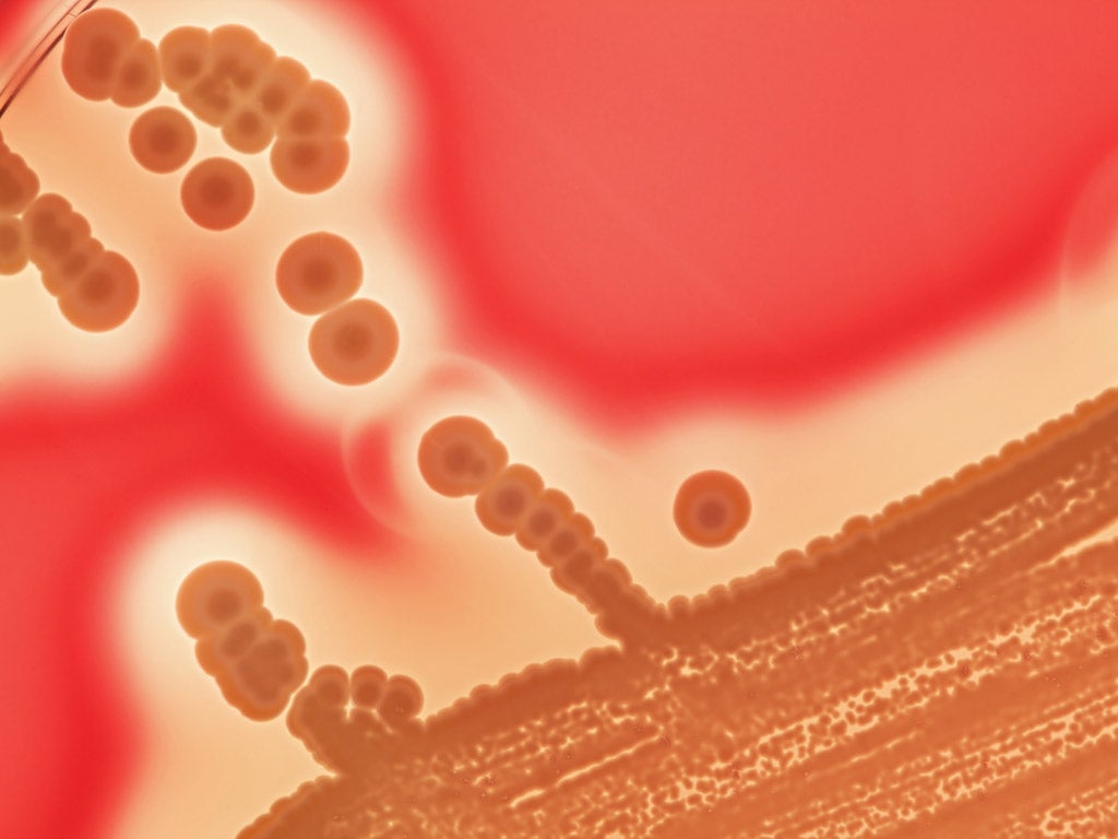 Staphylococcus aureus colonies on blood agar plate