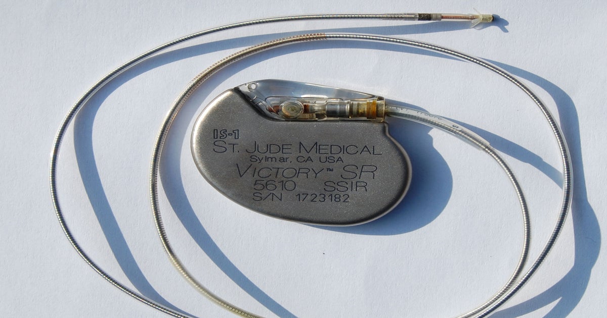 St. Jude Pacemaker