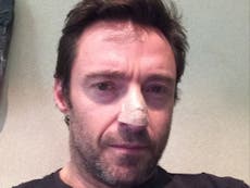 Wolverine star Hugh Jackman treated for skin cancer