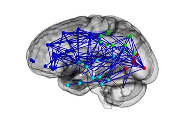 Brain networks in males (upper) and in females (lower)
