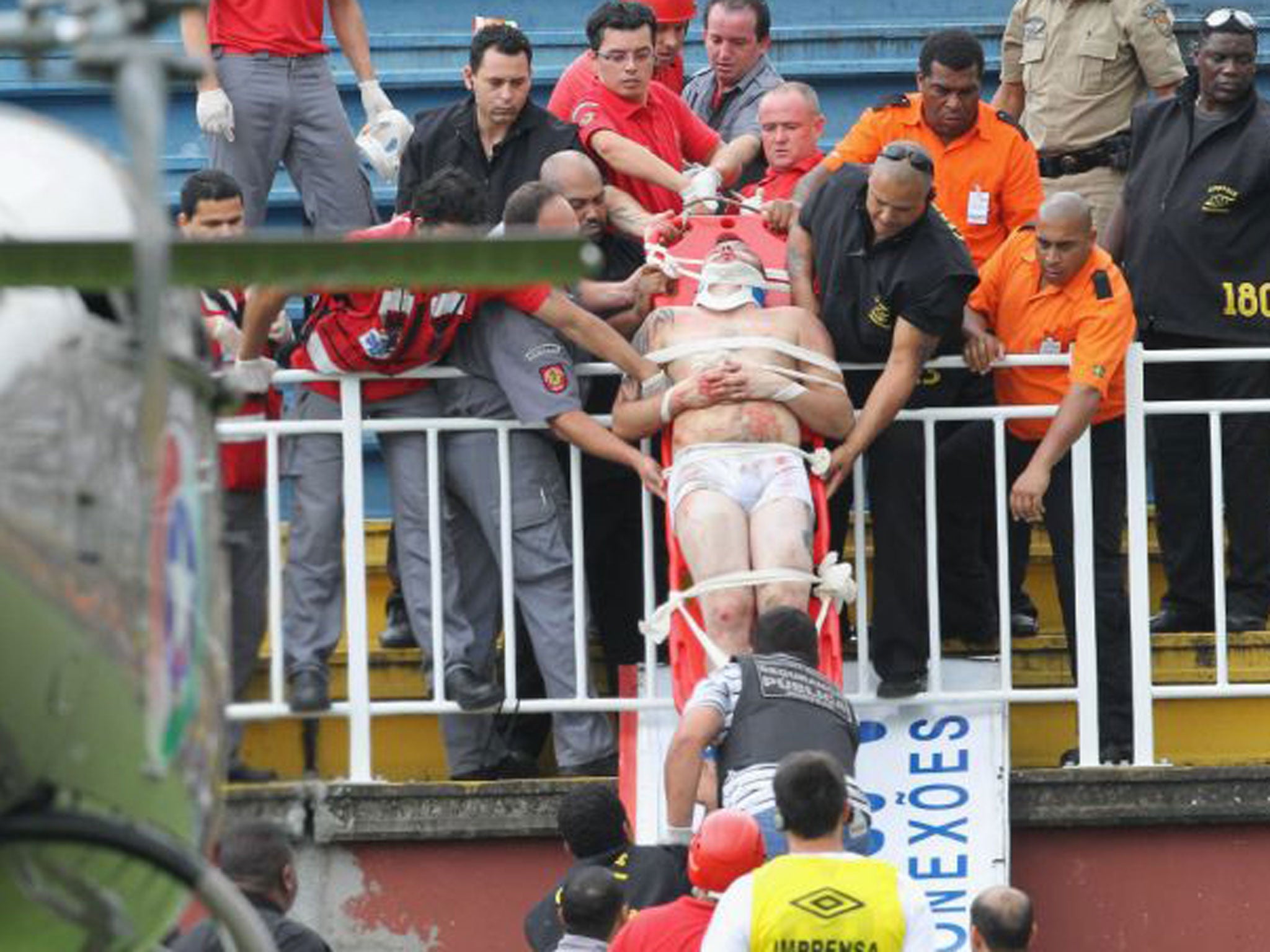 An injured fan is carried on a stretcher after clashes with team fans during a Brazilian league soccer match between Atletico Paranaense and Vasco da Gama in Joinville, southern Brazil on Sunday