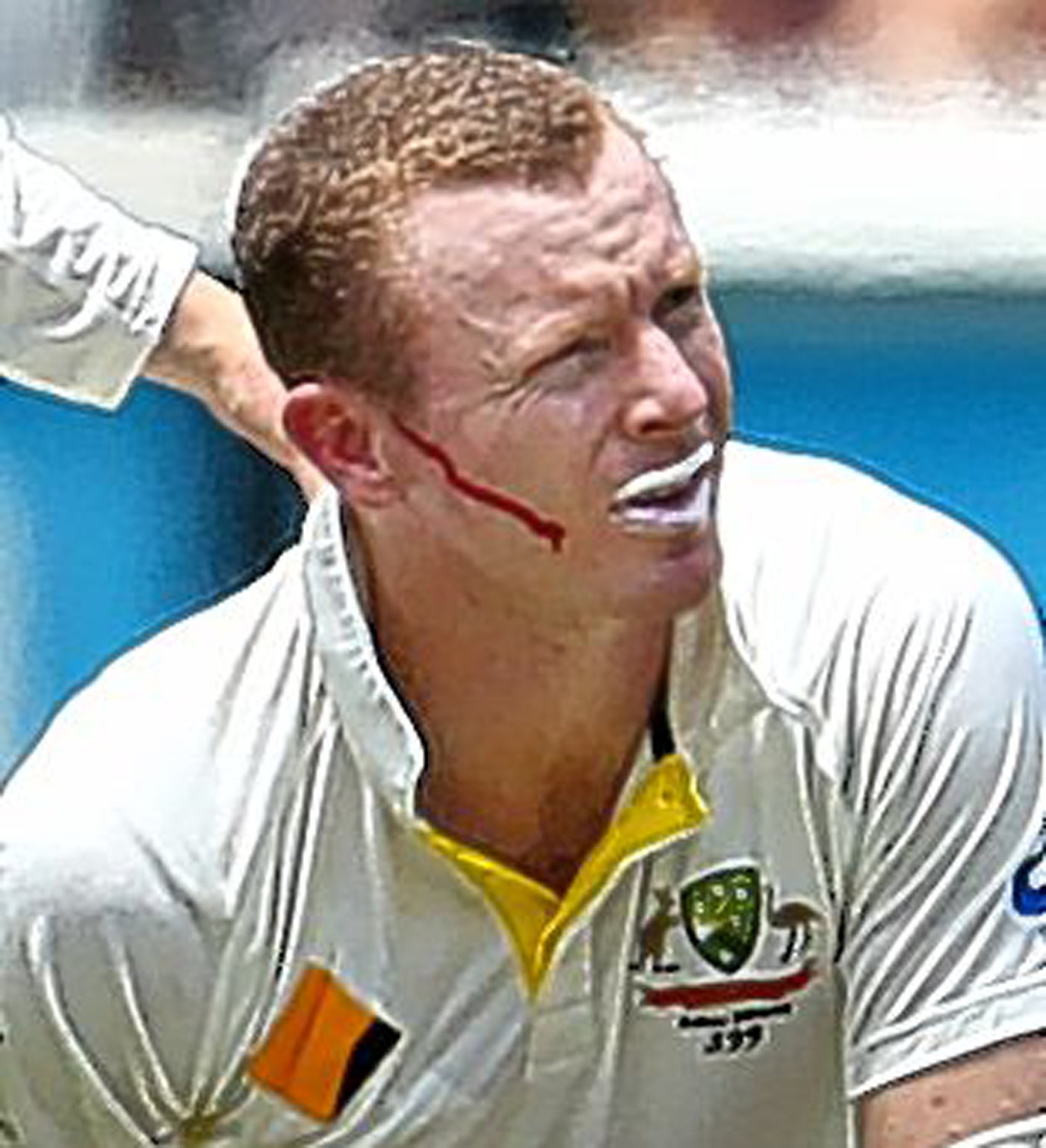 Chris Rogers is left bleeding after being hit by a Stuart Broad delivery