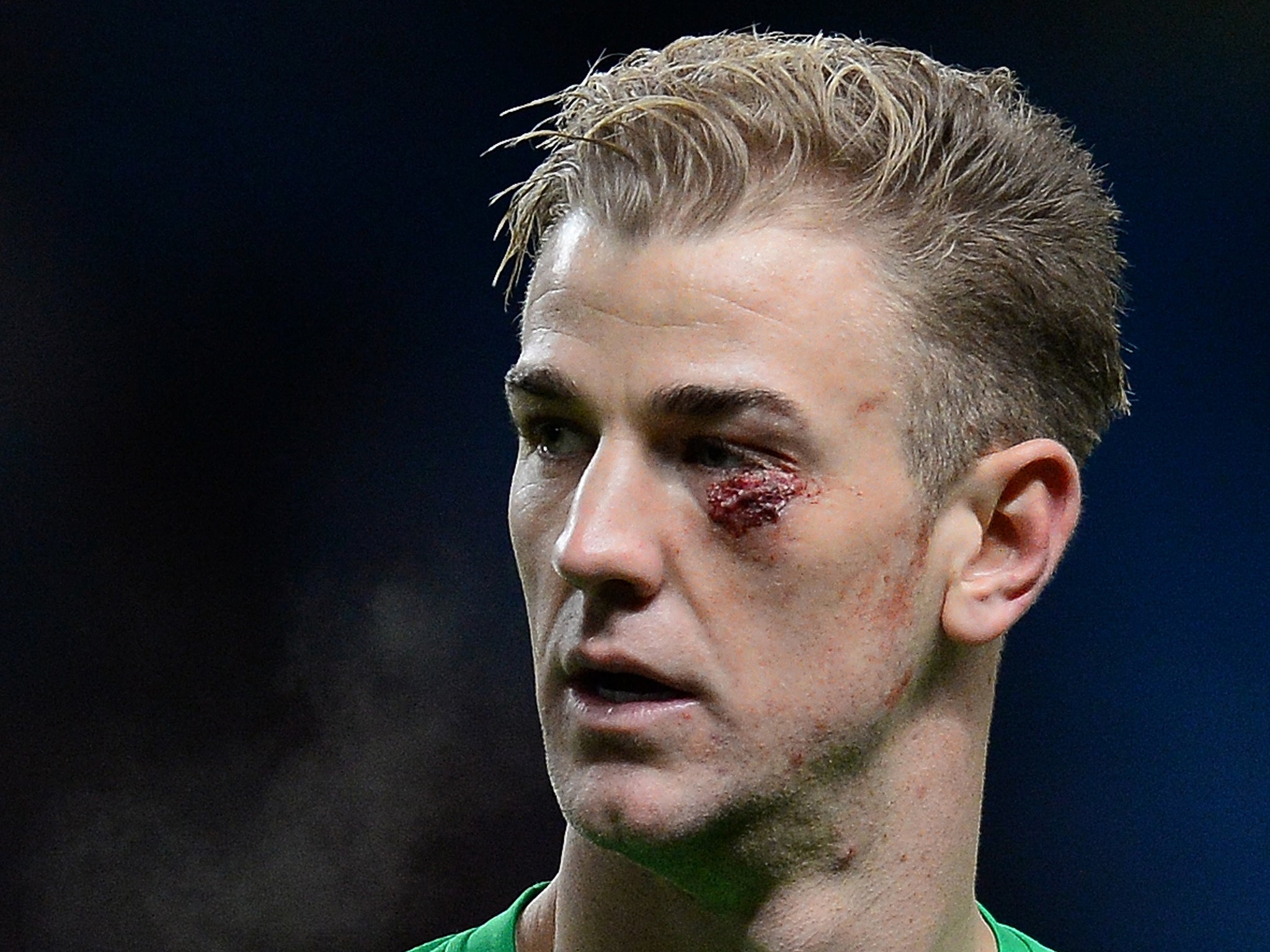 Joe Hart suffered a nasty looking cut which required five stitches in Manchester City's 1-0 victory over Crystal Palace