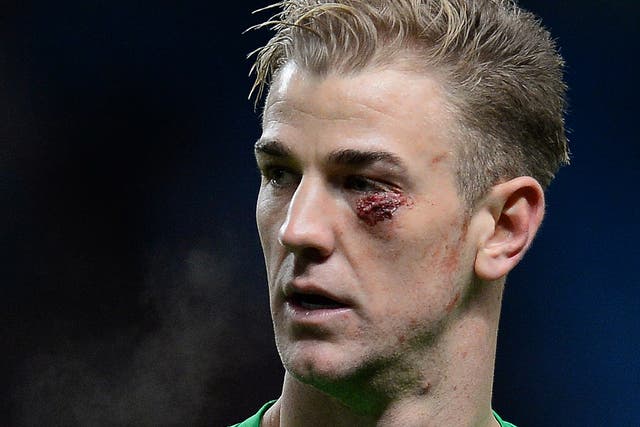 Joe Hart suffered a nasty looking cut which required five stitches in Manchester City's 1-0 victory over Crystal Palace