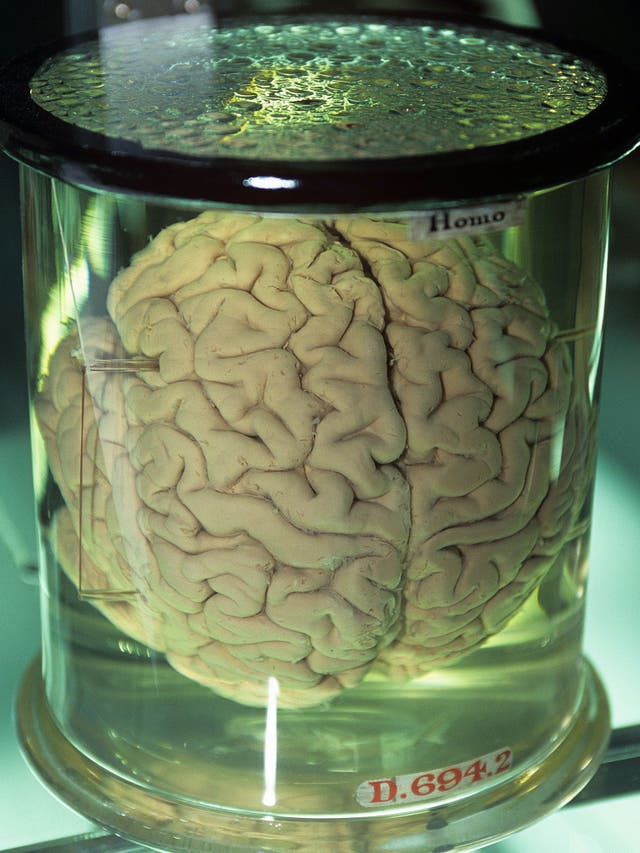 A man has been arrested for selling brains on eBay