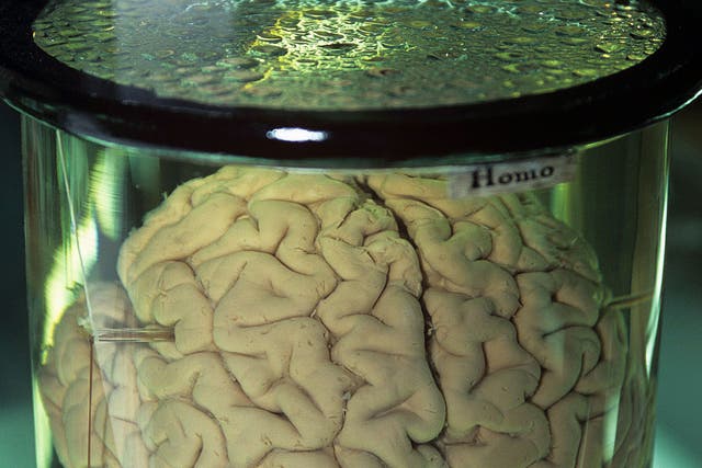 A man has been arrested for selling brains on eBay