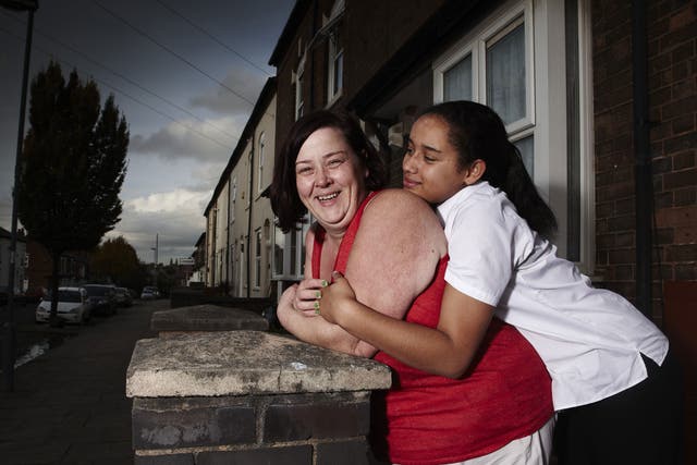 Dee and Caitlin from 'Benefits Street'