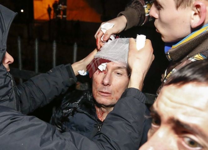 Former Ukrainian Minister of Internal Affairs Yuriy Lutsenko is being treated after being injured during clashes with police as he took part in a protest near the Kyiv Svyatoshinskyi district court in Kiev, Ukraine, 11 January 2014, where guilty verdicts