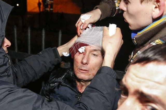 Former Ukrainian Minister of Internal Affairs Yuriy Lutsenko is being treated after being injured during clashes with police as he took part in a protest near the Kyiv Svyatoshinskyi district court in Kiev, Ukraine, 11 January 2014, where guilty verdicts 