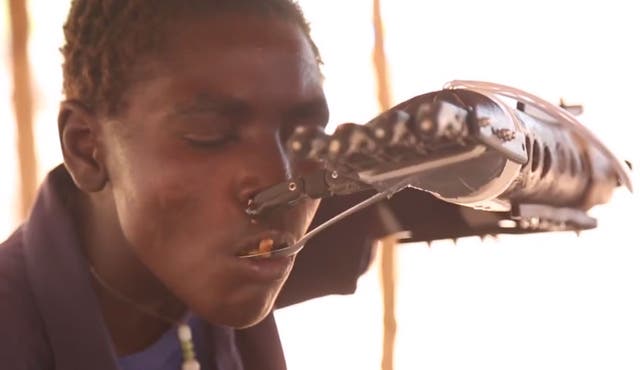 Daniel Omar and his 3D-printed prosthetic arm.