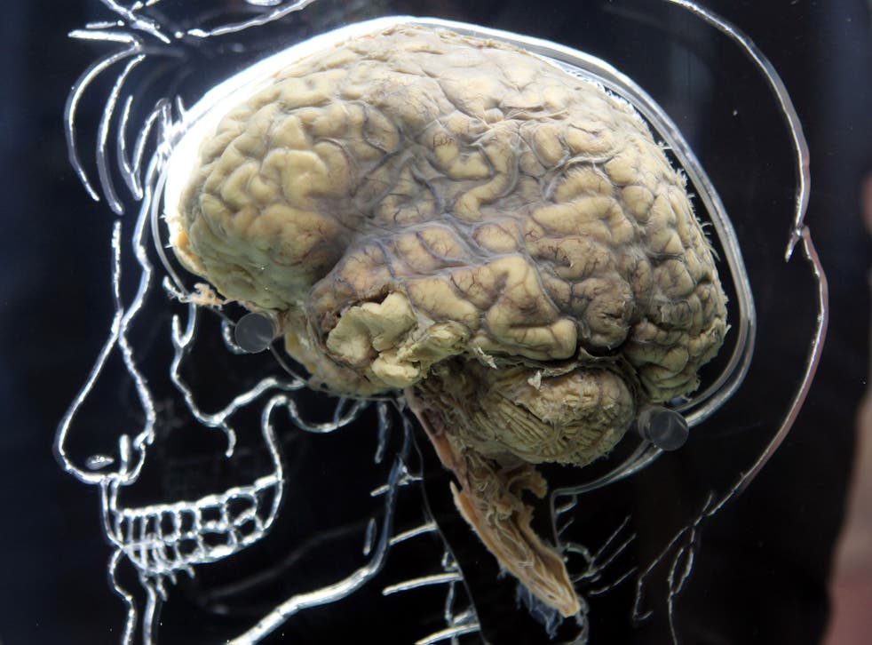 A real human brain is displayed in a 2011 Bristol exhibition