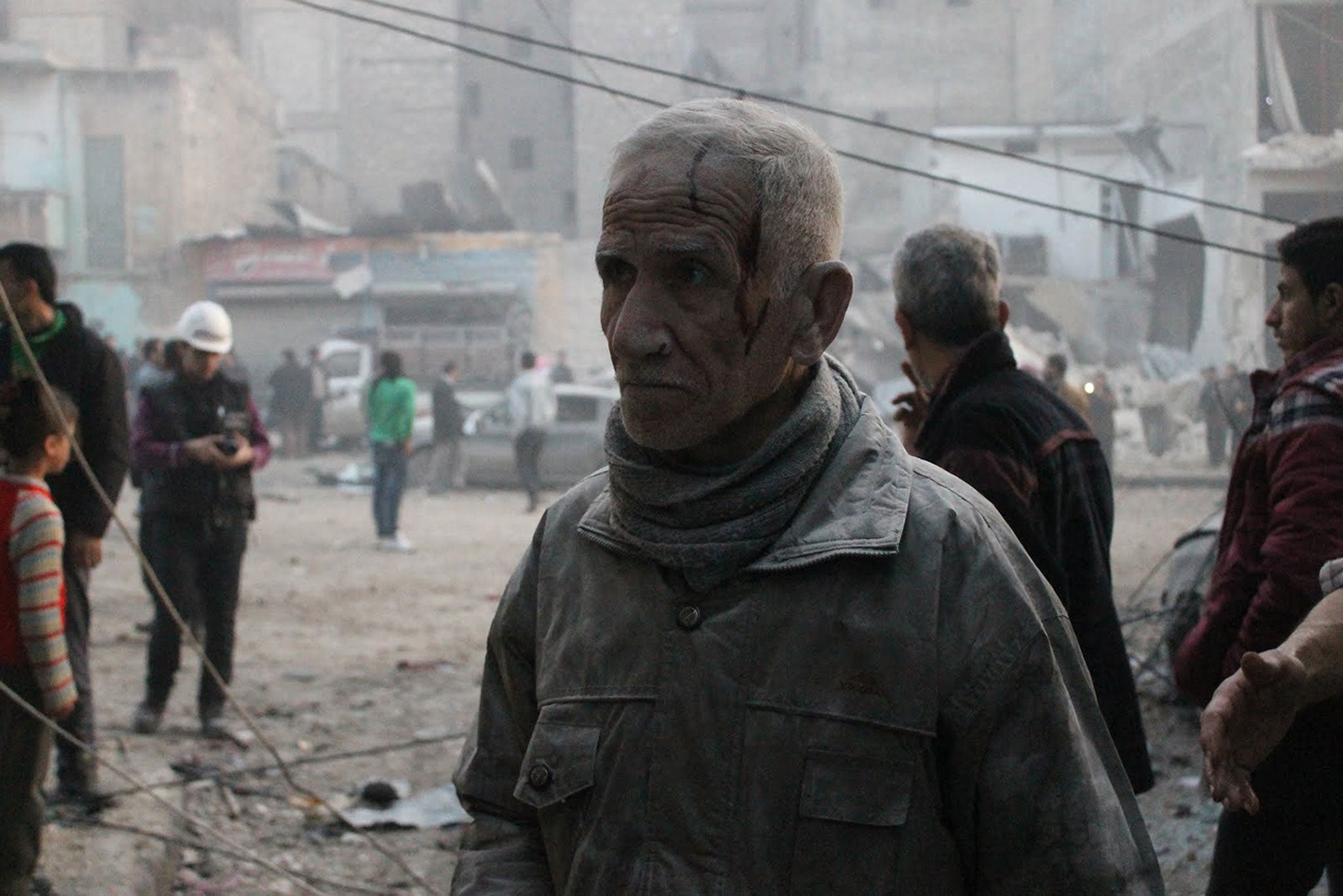 A bloodied Syrian man stands after a government airstrike on Aleppo