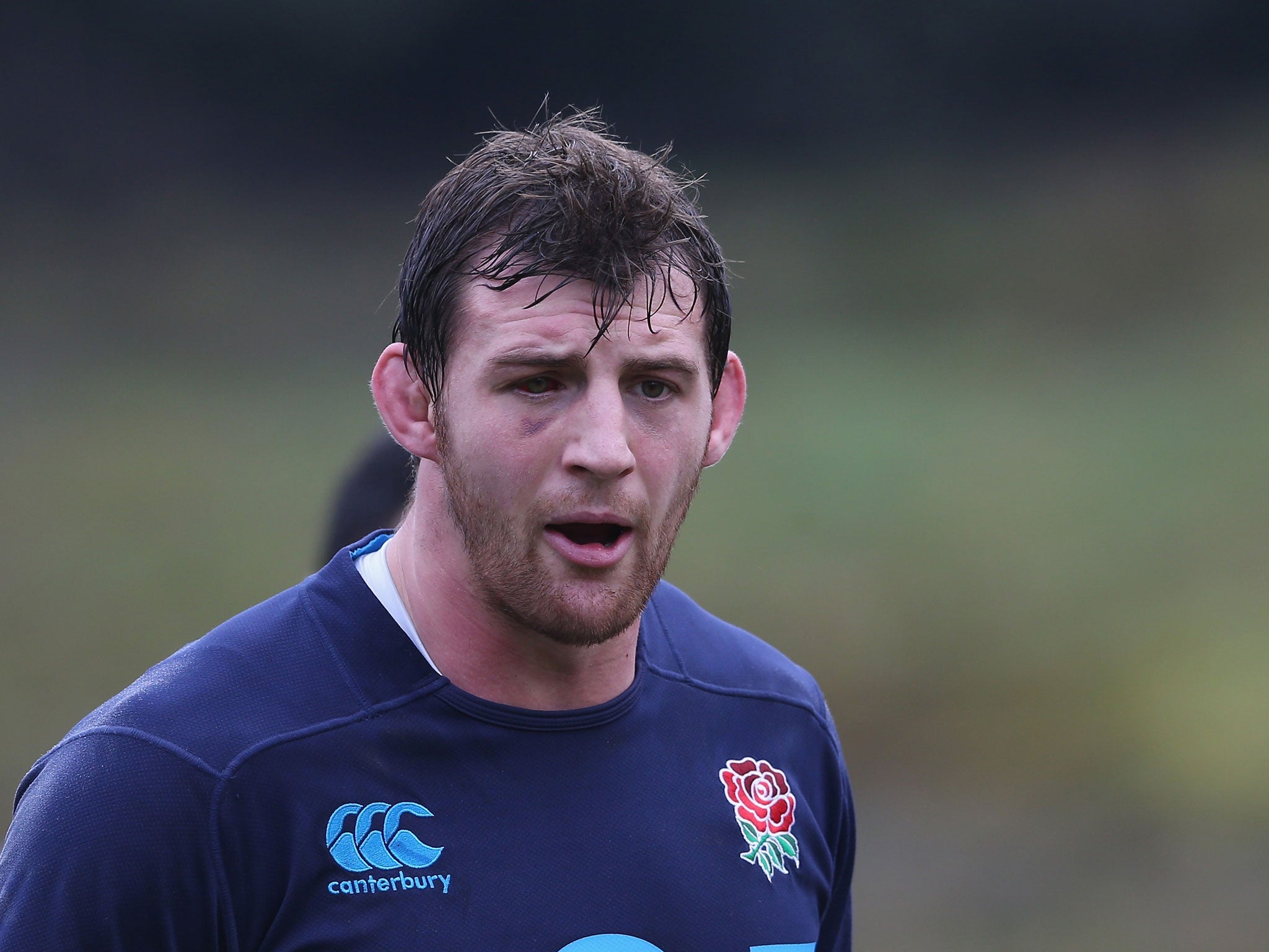 Tom Wood sports a shiner from a clash of heads during England training at Pennyhill Park