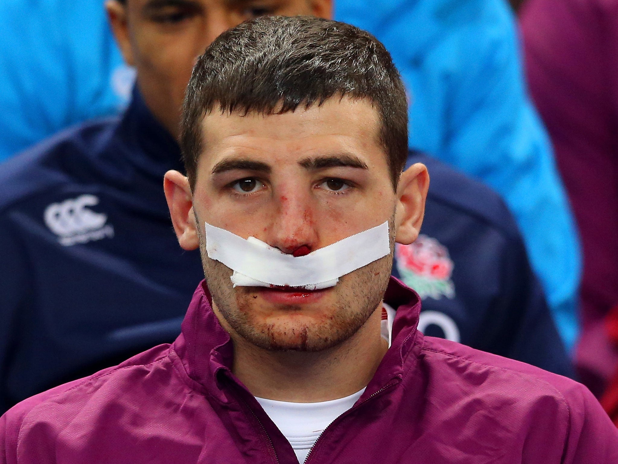 England wing Jonny May could miss the Calcutta Cup clash with Scotland due to a broken nose he suffered in the defeat to France