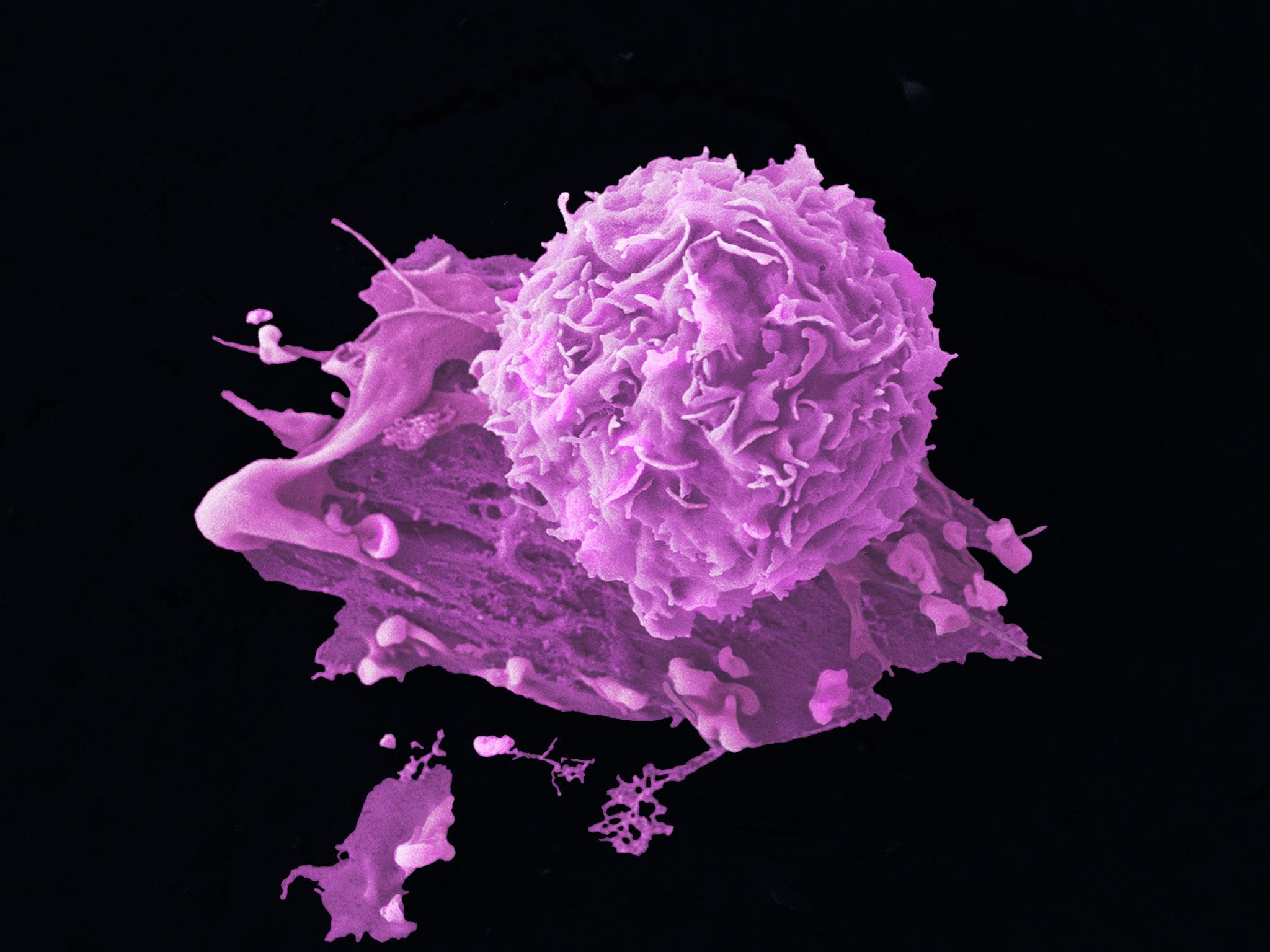 The breast cancer cell