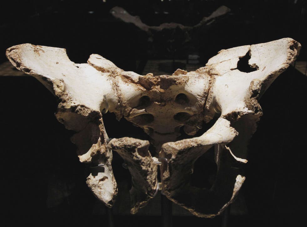 View of a the pelvis bone at the Museum of Human Evolution, unrelated to the man who suffered from a rare form of cancer had half of his pelvis replaced with a 3D-printed version.