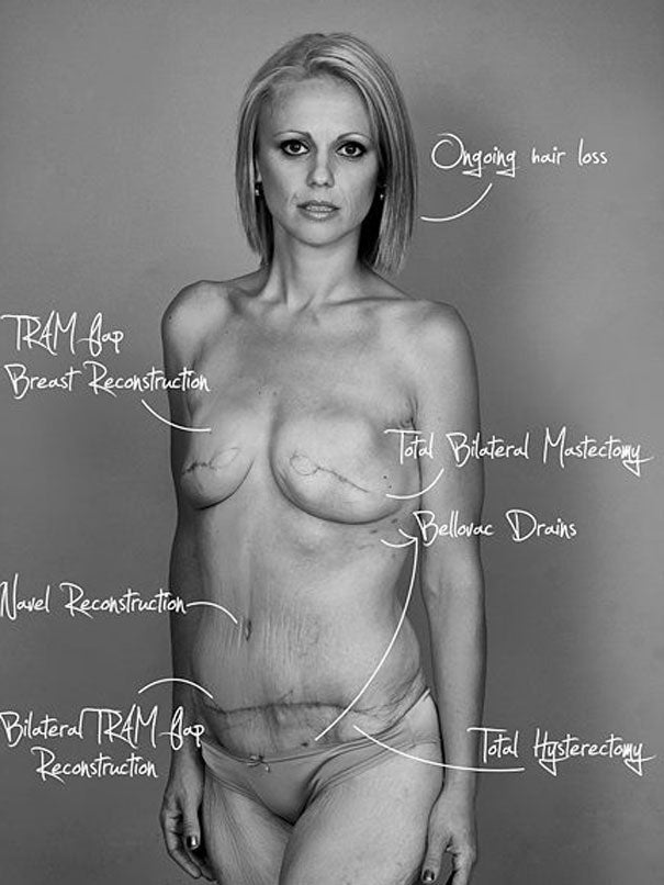 Beth Whaanga posted the images to highlight the realities of breast cancer