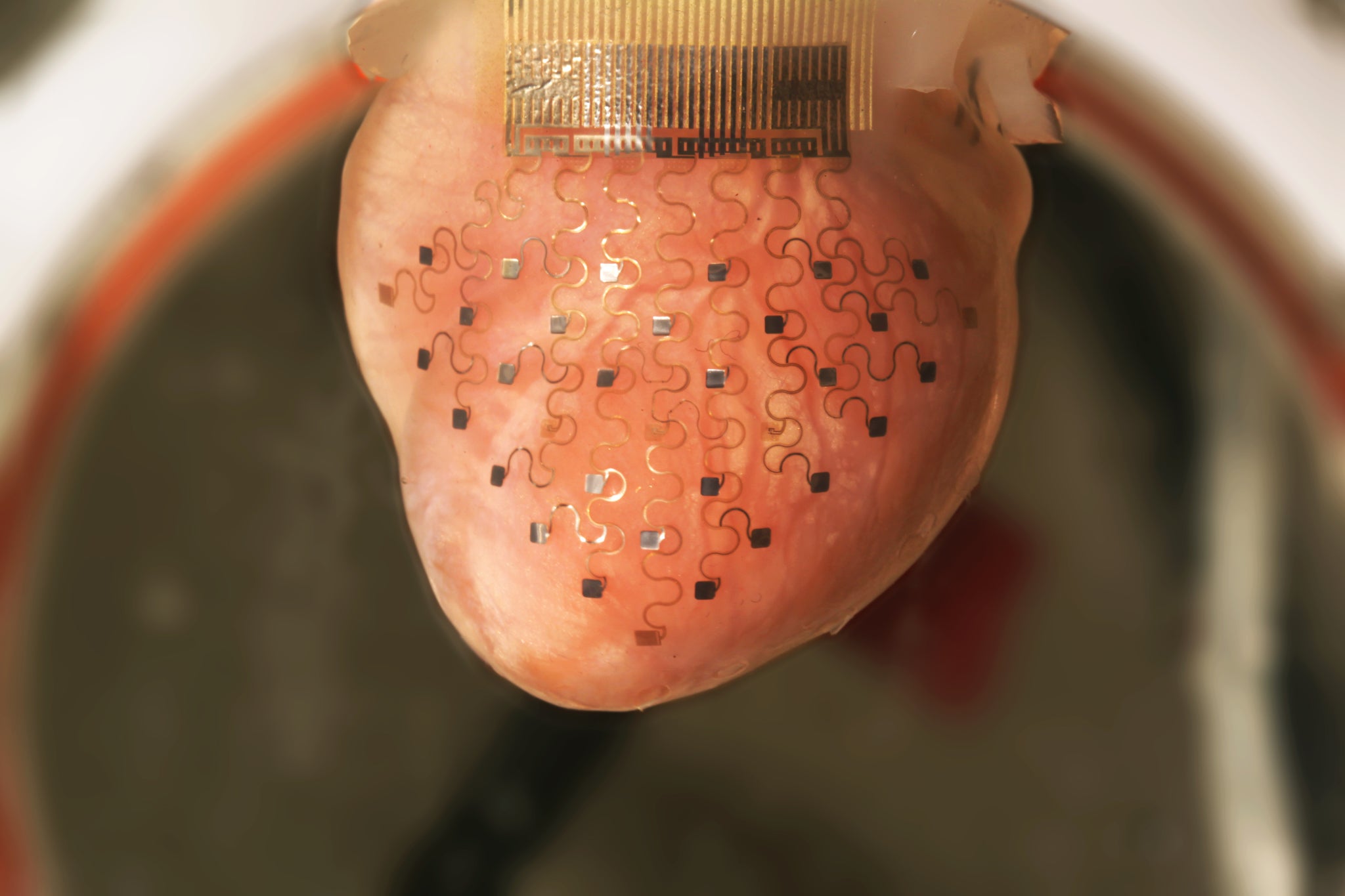 This photo shows the new cardiac device ― a thin, elastic membrane ― fitted over a rabbit's heart.