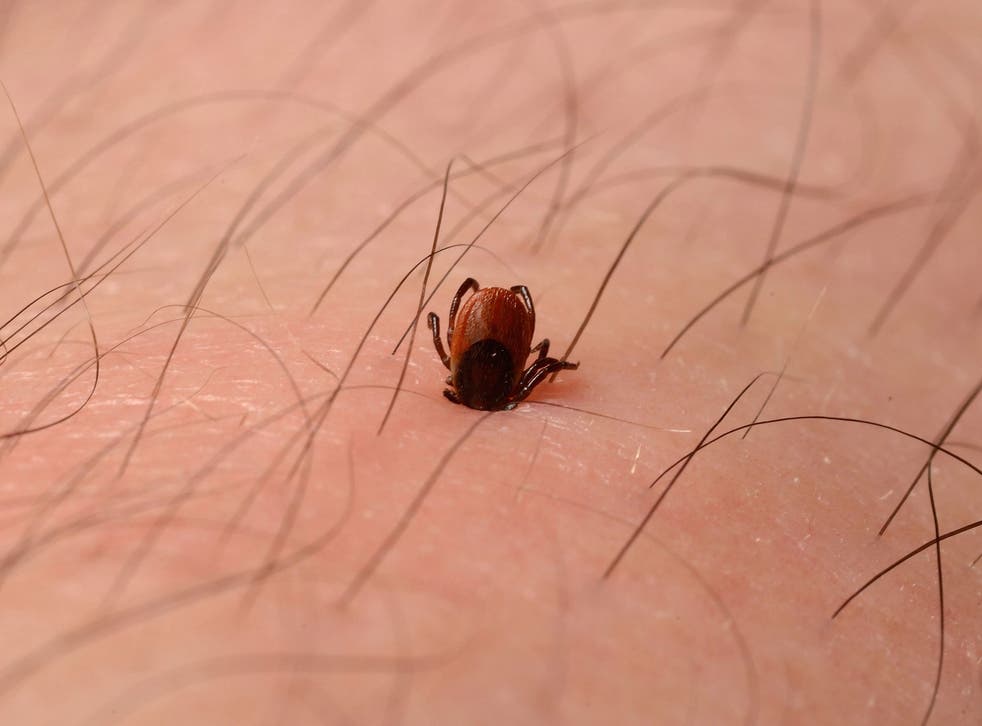 Deer tick embedded in skin of leg. A tick (Ixodes Ricinus) attached to the leg of a man