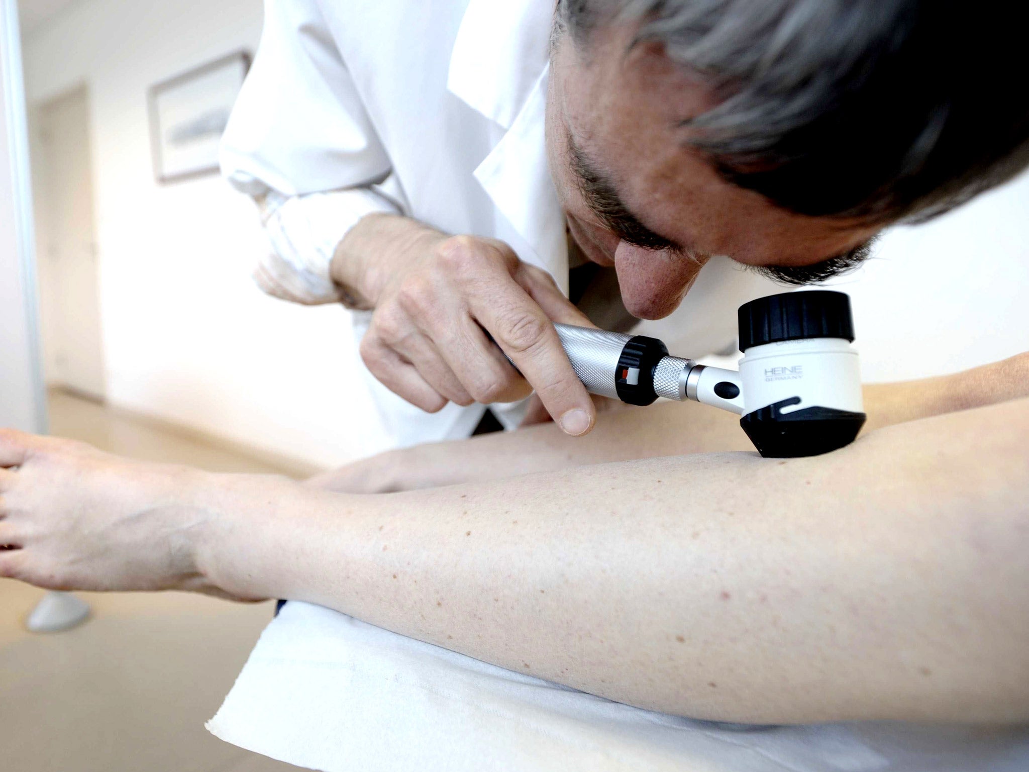 A dermatologist detecting the presence of melanoma on the skin