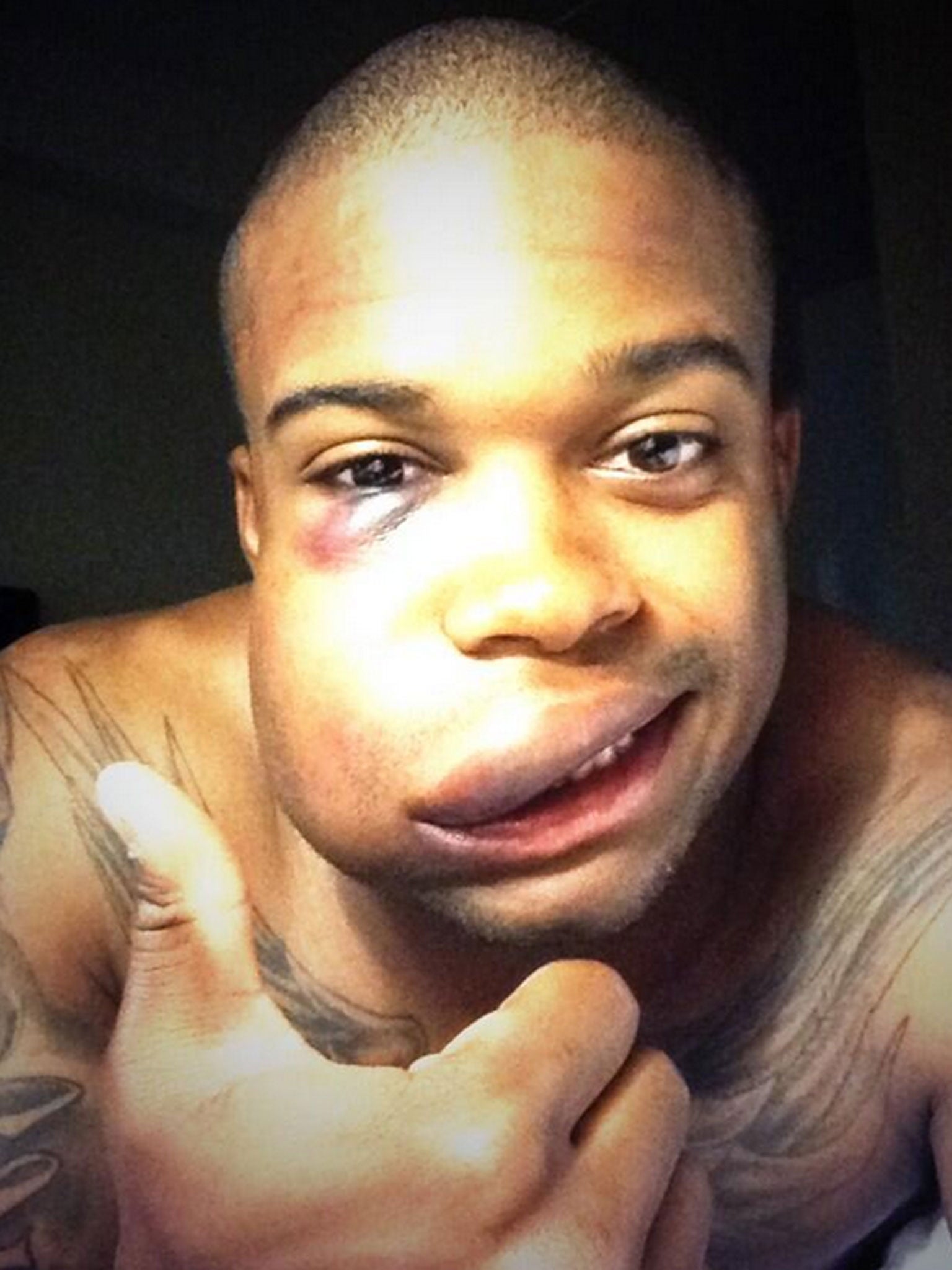 Delino DeShields Jr takes 90 mph fastball to the face
