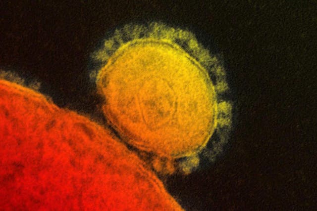 Public Health England (PHE) said the non-UK national was diagnosed with Middle East Respiratory Syndrome coronavirus (MERS-CoV) today