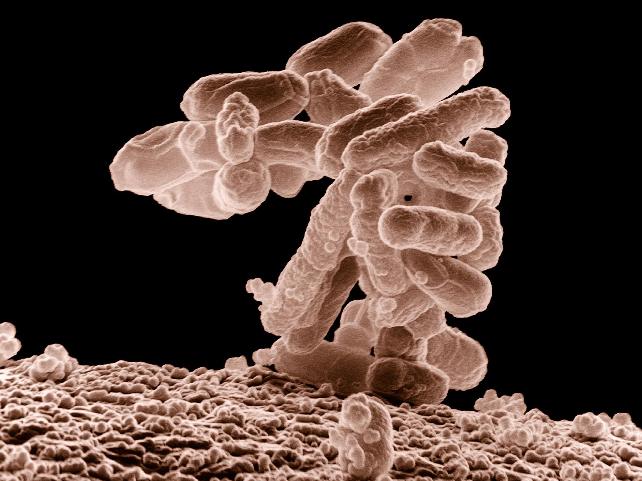 Low-temperature electron micrograph of a cluster of E. coli bacteria