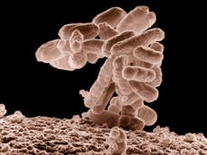 Scientists find vulnerability that may hold key to killing superbugs