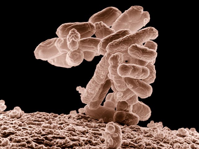 E. coli is a major cause of food poisoning and hospital infections