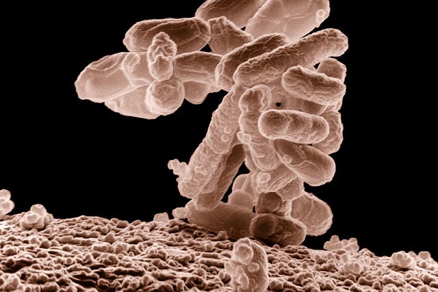 E. coli is a major cause of food poisoning and hospital infections