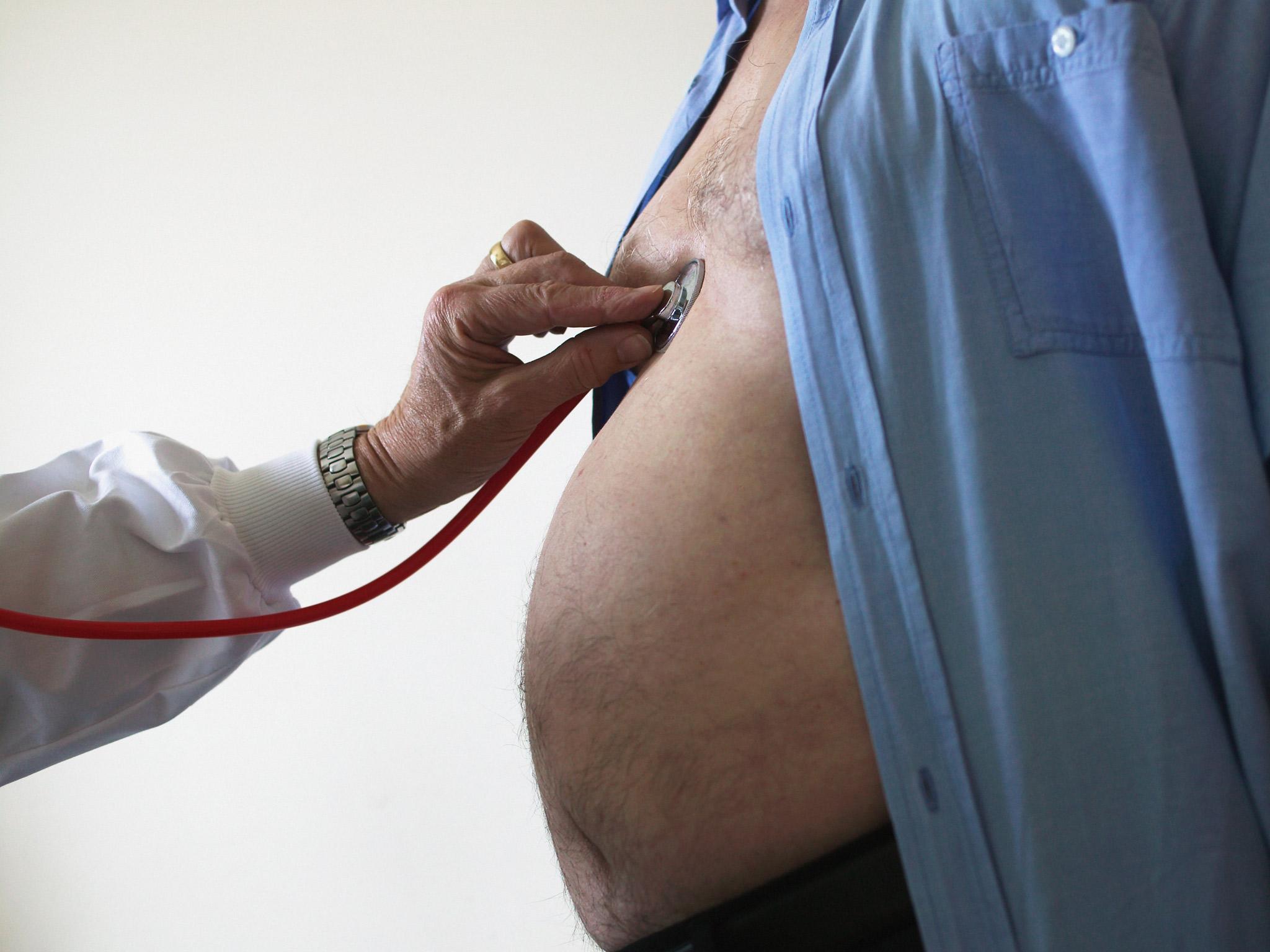 More than a quarter of UK adults are obese