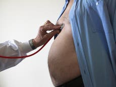 UK obesity crisis will cause 360,000 cancers by 2030, NHS warns