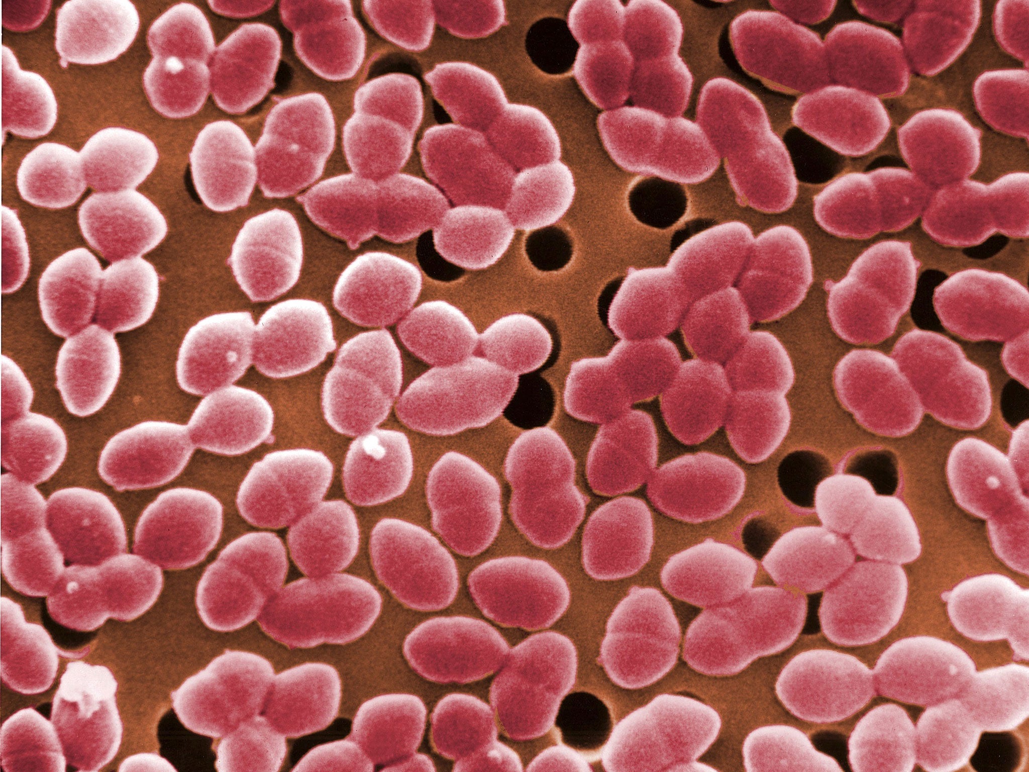E. coli în penis