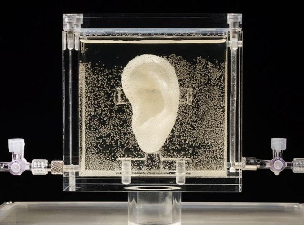 Van Gogh's 'living' ear exhibited at German museum | The Independent