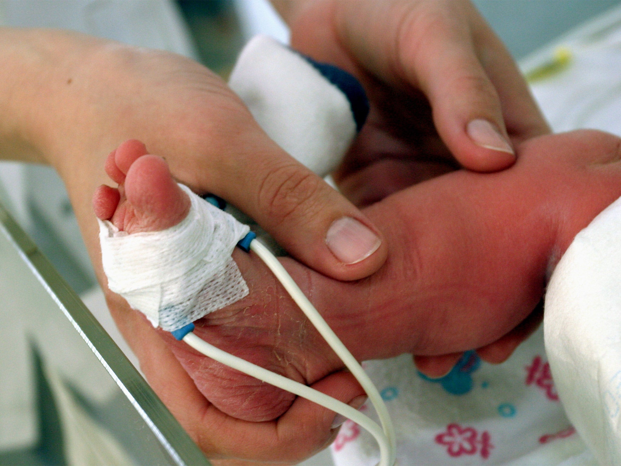 A premature baby in intensive care