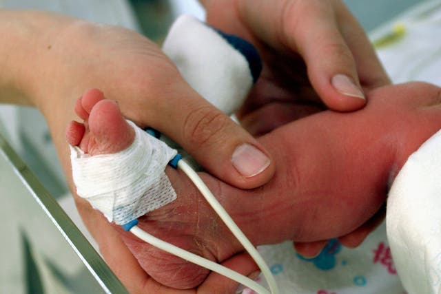 A premature baby in intensive care