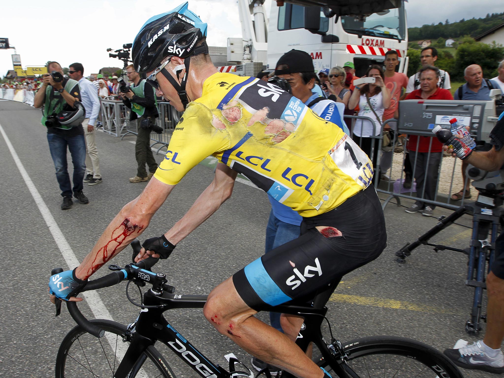 Chris Froome shows the effects of yesterday’s crash