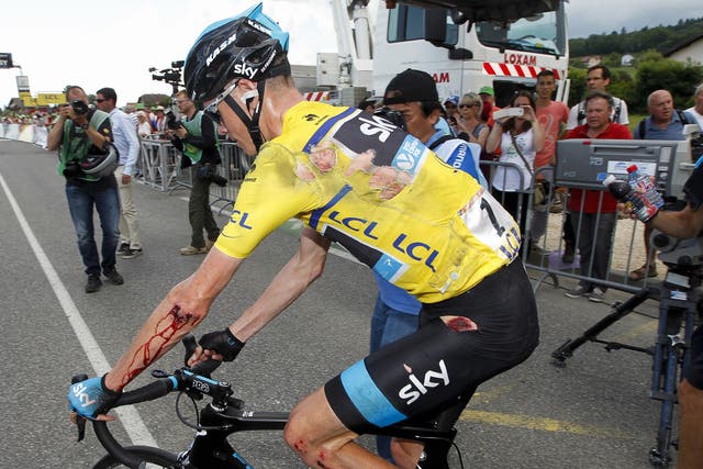 Chris Froome shows the effects of yesterday’s crash