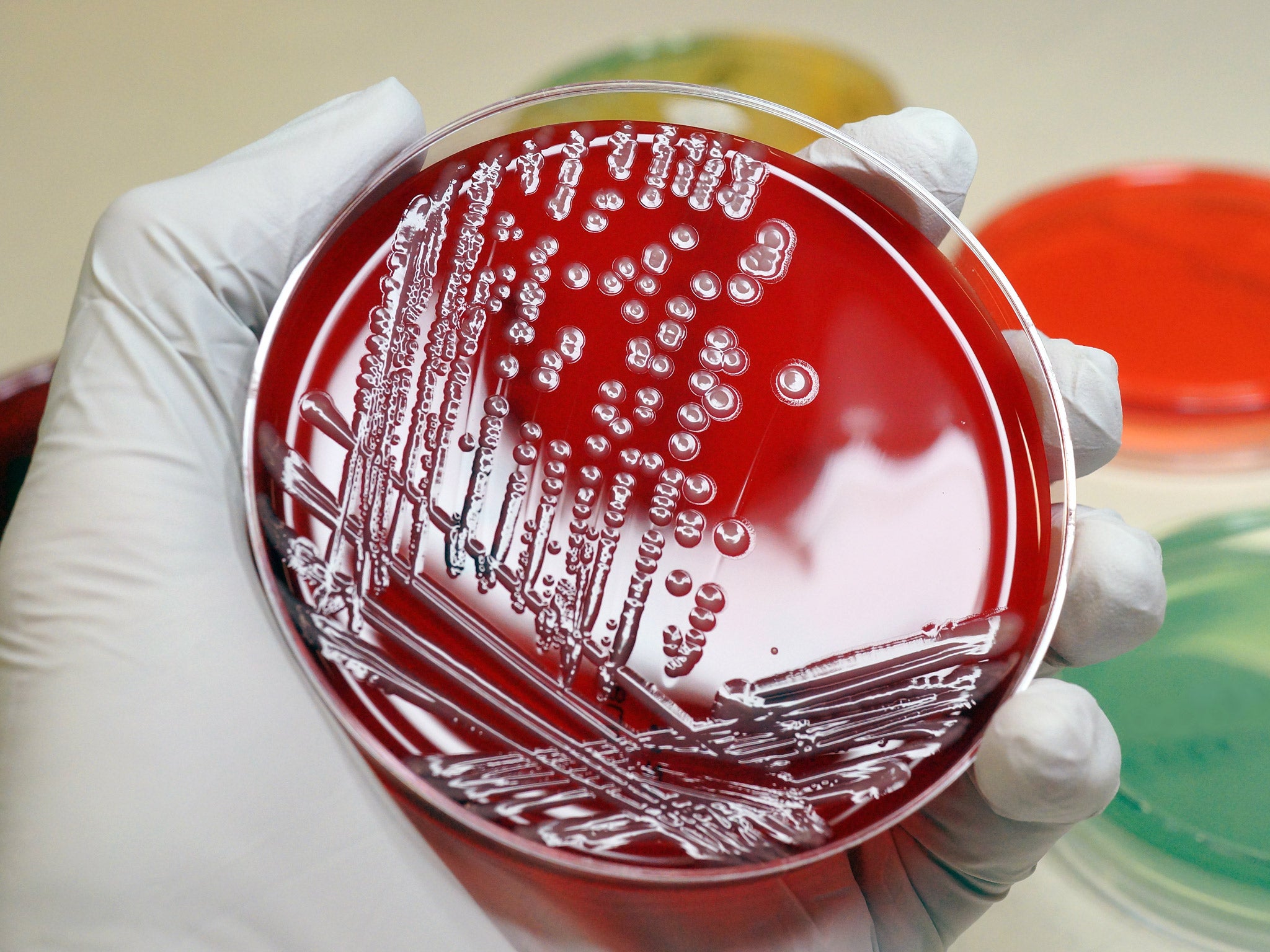 Colonies of a multi-resistant coliform bacteria (E.coli) 